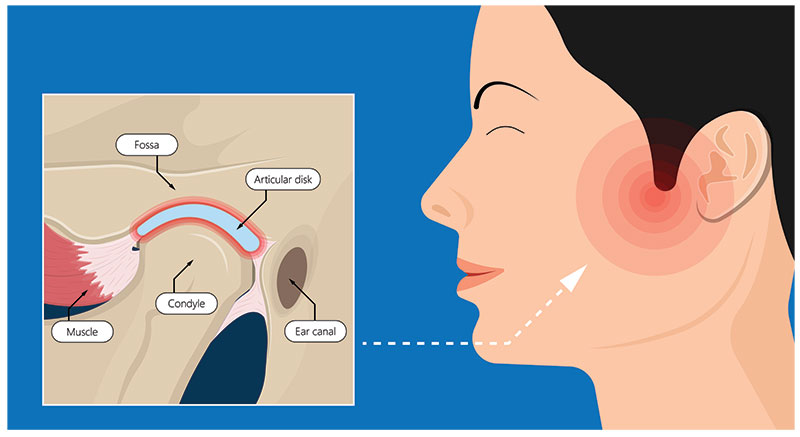 anatomy of the tmj